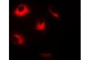Immunofluorescent analysis of Dopamine Receptor D5 staining in Hela cells.