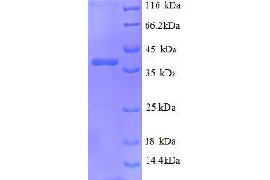 SDS-PAGE (SDS) image for Nephronophthisis 1 (Juvenile) (NPHP1) (AA 1-109), (partial) protein (GST tag) (ABIN4976385) (NPHP1 Protein (AA 1-109, partial) (GST tag))