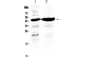 Western blot analysis of TFPI using anti- TFPI antibody . (TFPI antibody  (AA 253-304))