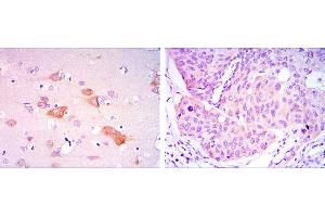 Immunohistochemistry (IHC) image for anti-SMAD, Mothers Against DPP Homolog 5 (SMAD5) antibody (ABIN969404)