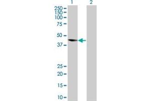 Western Blotting (WB) image for anti-Protein Kinase, AMP-Activated, gamma 2 Non-Catalytic Subunit (PRKAG2) (AA 1-328) antibody (ABIN526707)