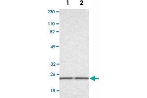 Western Blot analysis of Lane 1: RT-4 and Lane 2: U-251MG sp cell lysates with RAB13 polyclonal antibody .