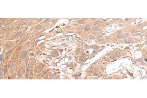 CHST4 antibody