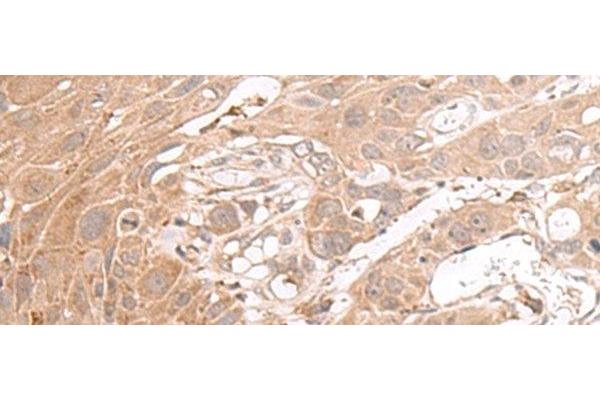 CHST4 antibody