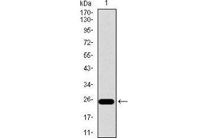 Western blot analysis using ITGB4 mAb against human ITGB4 recombinant protein.