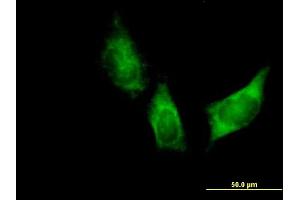 Immunofluorescence of purified MaxPab antibody to DARS on HeLa cell. (DARS antibody  (AA 1-501))