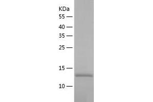 Western Blotting (WB) image for Thiosulfate Sulfurtransferase (Rhodanese)-Like Domain Containing 1 (TSTD1) (AA 1-115) protein (His tag) (ABIN7125371)