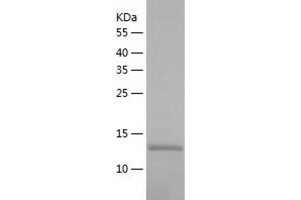 TSTD1 Protein (AA 1-115) (His tag)