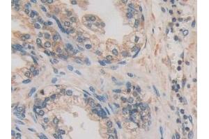 Immunohistochemistry (IHC) image for anti-Calcyclin Binding Protein (CACYBP) (AA 2-228) antibody (ABIN7434842)