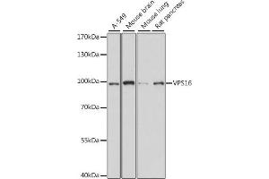 Western blot analysis of extracts of various cell lines, using VPS16 antibody (ABIN7271281) at 1:1000 dilution. (VPS16 antibody  (AA 540-839))