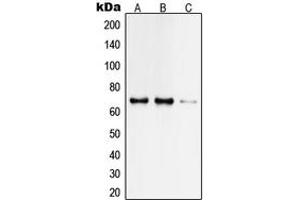 Western blot analysis of TAF6L expression in HeLa (A), Jurkat (B), rat brain (C) whole cell lysates. (TAF6L antibody  (N-Term))