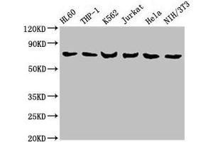 Western Blot Positive WB detected in: HL60 whole cell lysate, THP-1 whole cell lysate, K562 whole cell lysate, Jurkat whole cell lysate, Hela whole cell lysate, NIH/3T3 whole cell lysate All lanes: LCP1 antibody at 8 μg/mL Secondary Goat polyclonal to rabbit IgG at 1/10000 dilution Predicted band size: 71, 22 kDa Observed band size: 71 kDa (LCP1 antibody  (AA 2-627))