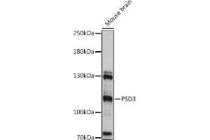 PSD3 antibody