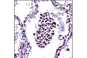 NFKBIB Antibody (C-term) ((ABIN657702 and ABIN2846693))immunohistochemistry analysis in formalin fixed and paraffin embedded human lung tissue followed by peroxidase conjugation of the secondary antibody and DAB staining. (NFKBIB antibody  (C-Term))