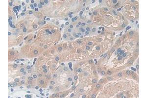 IHC-P analysis of Mouse Kidney Tissue, with DAB staining. (CPB1 antibody  (AA 109-415))
