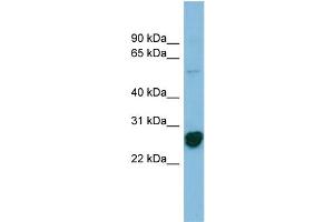 WB Suggested Anti-RPL10A Antibody Titration: 0. (RPL10A antibody  (N-Term))