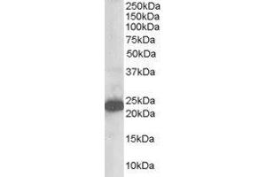 ABIN2560214 staining (1µg/ml) of Human Brain lysate (RIPA buffer, 35µg total protein per lane). (STMN2 antibody  (N-Term))