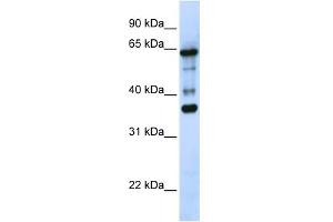WB Suggested Anti-ZNF630 Antibody Titration:  0. (ZNF630 antibody  (N-Term))