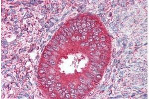 Human Uterus (formalin-fixed, paraffin-embedded) stained with CDX2 antibody ABIN214089 at 5 ug/ml followed by biotinylated goat anti-rabbit IgG secondary antibody ABIN481713, alkaline phosphatase-streptavidin and chromogen.