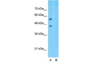 Host:  Rabbit  Target Name:  SLC15A4  Sample Type:  293T  Lane A:  Primary Antibody  Lane B:  Primary Antibody + Blocking Peptide  Primary Antibody Concentration:  1ug/ml  Peptide Concentration:  5ug/ml  Lysate Quantity:  25ug/lane/lane  Gel Concentration:  0. (SLC15A4 antibody  (Middle Region))