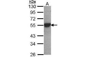 Image no. 2 for anti-Cytochrome P450, Family 2, Subfamily D, Polypeptide 6 (CYP2D6) (AA 268-457) antibody (ABIN467616) (CYP2D6 antibody  (AA 268-457))