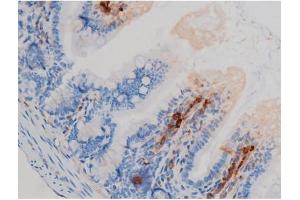 ABIN6267438 at 1/200 staining Mouse intestinal tissue sections by IHC-P. (RPS6KB1 antibody  (pSer371))