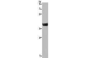 Western Blotting (WB) image for anti-Hydroxysteroid (17-Beta) Dehydrogenase 2 (HSD17B2) antibody (ABIN2423607) (HSD17B2 antibody)