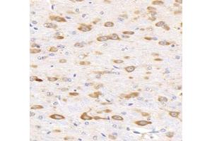 Immunohistochemistry analysis of paraffin-embedded mouse brain using,KCNG3 (ABIN7075157) at dilution of 1: 2000 (KCNG3 antibody)