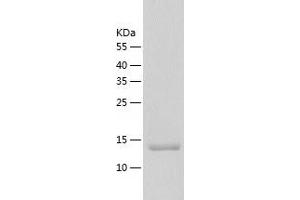 Western Blotting (WB) image for Proteasome (Prosome, Macropain) Assembly Chaperone 3 (PSMG3) (AA 1-122) protein (His tag) (ABIN7288596) (PSMG3 Protein (AA 1-122) (His tag))