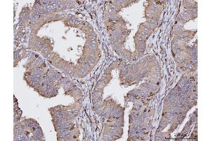 IHC analysis of HLA-DRA using anti-HLA-DRA antibody (ABIN7600949). (HLA-DRA antibody  (AA 26-254))