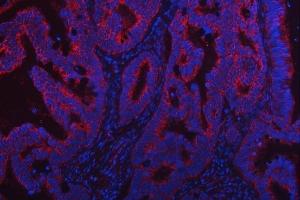 IF analysis of TRMT2B using anti-TRMT2B antibody (ABIN7599456). (TRMT2B antibody  (AA 1-504))