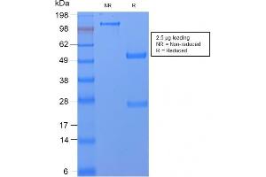 SDS-PAGE Analysis Purified CD59 Rabbit Recombinant Monoclonal Antibody (MACIF/2867R). (Recombinant CD59 antibody)