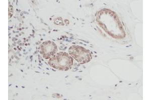Image no. 1 for anti-Cardiotrophin 1 (CTF1) antibody (ABIN465486) (Cardiotrophin 1 antibody)