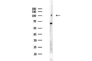 Western blot analysis of lysates from F10-LUC cells(heat-shock 45 min treatment), using SLFN5 Antibody at 1/1000 dilution.