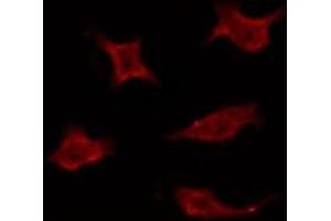 ABIN6275935 staining Hela by IF/ICC. (LPAR3 antibody  (Internal Region))