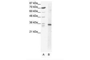 Image no. 1 for anti-Kruppel-Like Factor 3 (Basic) (KLF3) (AA 53-102) antibody (ABIN202293) (KLF3 antibody  (AA 53-102))