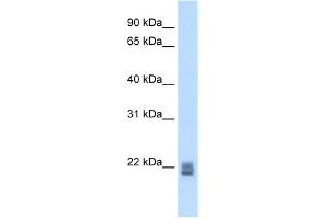 WB Suggested Anti-Rgs1 Antibody Titration:  5. (RGS1 antibody  (N-Term))