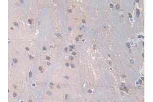 Detection of PDXK in Mouse Brain Tissue using Polyclonal Antibody to Pyridoxal Kinase (PDXK)