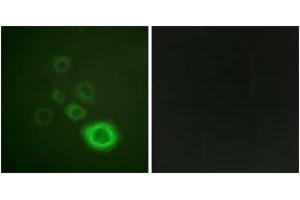 Image no. 2 for anti-Met Proto-Oncogene (MET) (AA 976-1025) antibody (ABIN2888809) (c-MET antibody  (AA 976-1025))