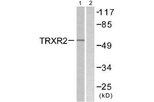 Western Blotting (WB) image for anti-Thioredoxin Reductase 2 (TXNRD2) (C-Term) antibody (ABIN1848862) (TXNRD2 antibody  (C-Term))
