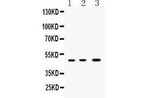 Western blot analysis of Nanog expression in rat ovary extract ( Lane 1), mouse ovary extract ( Lane 2) and MCF-7 whole cell lysates ( Lane 3). (Nanog antibody  (Middle Region))