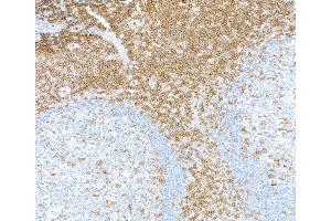 Immunohistochemistry (IHC) image for anti-CD3 epsilon (CD3E) (AA 139-189) antibody (ABIN7454000) (Recombinant CD3 epsilon antibody  (AA 139-189))