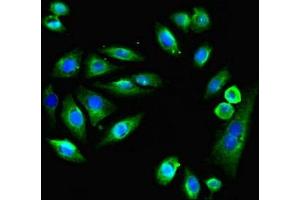 Immunofluorescent analysis of A549 cells using ABIN7151925 at dilution of 1:100 and Alexa Fluor 488-congugated AffiniPure Goat Anti-Rabbit IgG(H+L) (EMP1 antibody  (AA 22-66))