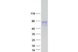 Western Blotting (WB) image for Chordin-Like 2 (CHRDL2) protein (Myc-DYKDDDDK Tag) (ABIN2713998)