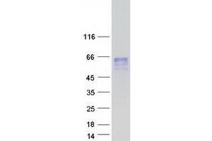 Validation with Western Blot (CHRDL2 Protein (Myc-DYKDDDDK Tag))