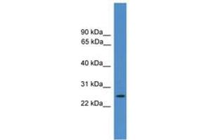 Image no. 1 for anti-Eukaryotic Translation Initiation Factor 4E Family Member 2 (EIF4E2) (AA 60-109) antibody (ABIN6745423)