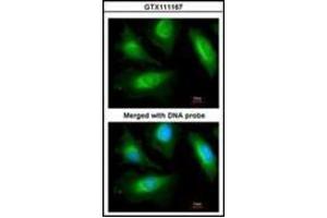 Immunofluorescence analysis of paraformaldehyde-fixed HeLa, using actinin, alpha 2 antibody at 1/200 dilution. (ACTN2 antibody)