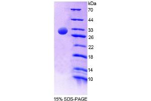 SDS-PAGE analysis of Human PTPN5 Protein. (PTPN5 Protein)