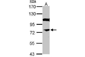 WB Image Sample (30 ug of whole cell lysate) A: IMR32 7. (NR4A3 antibody  (N-Term))