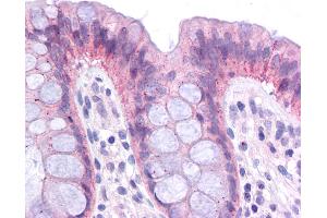 Immunohistochemistry (IHC) image for anti-CCAAT/enhancer Binding Protein (C/EBP), alpha (CEBPA) (Middle Region) antibody (ABIN2787465) (CEBPA antibody  (Middle Region))